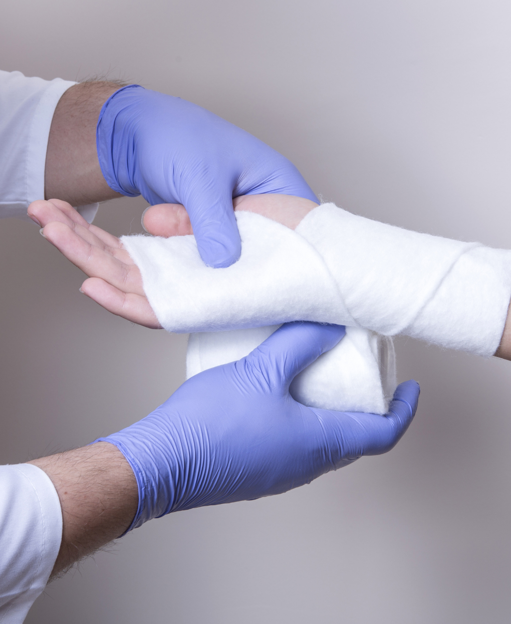 Tratamento de Feridas Crônicas com necrose aplicando pomada desbridante (Colagenase), serviço de enfermagem especializada Sanacurativos.